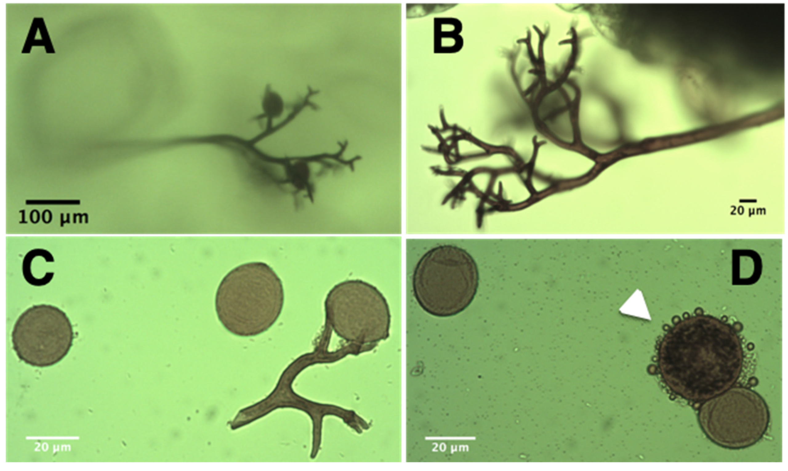 Микрофотографии спороносных структур Peronospora variabilis: спорангиеносцы, споры и ооспора